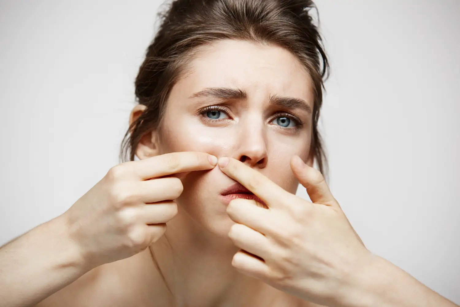 Warning against popping pimples showing potential scarring and inflammation