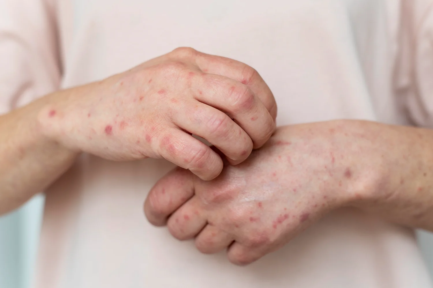 Visual examples of various skin conditions including rashes and infections