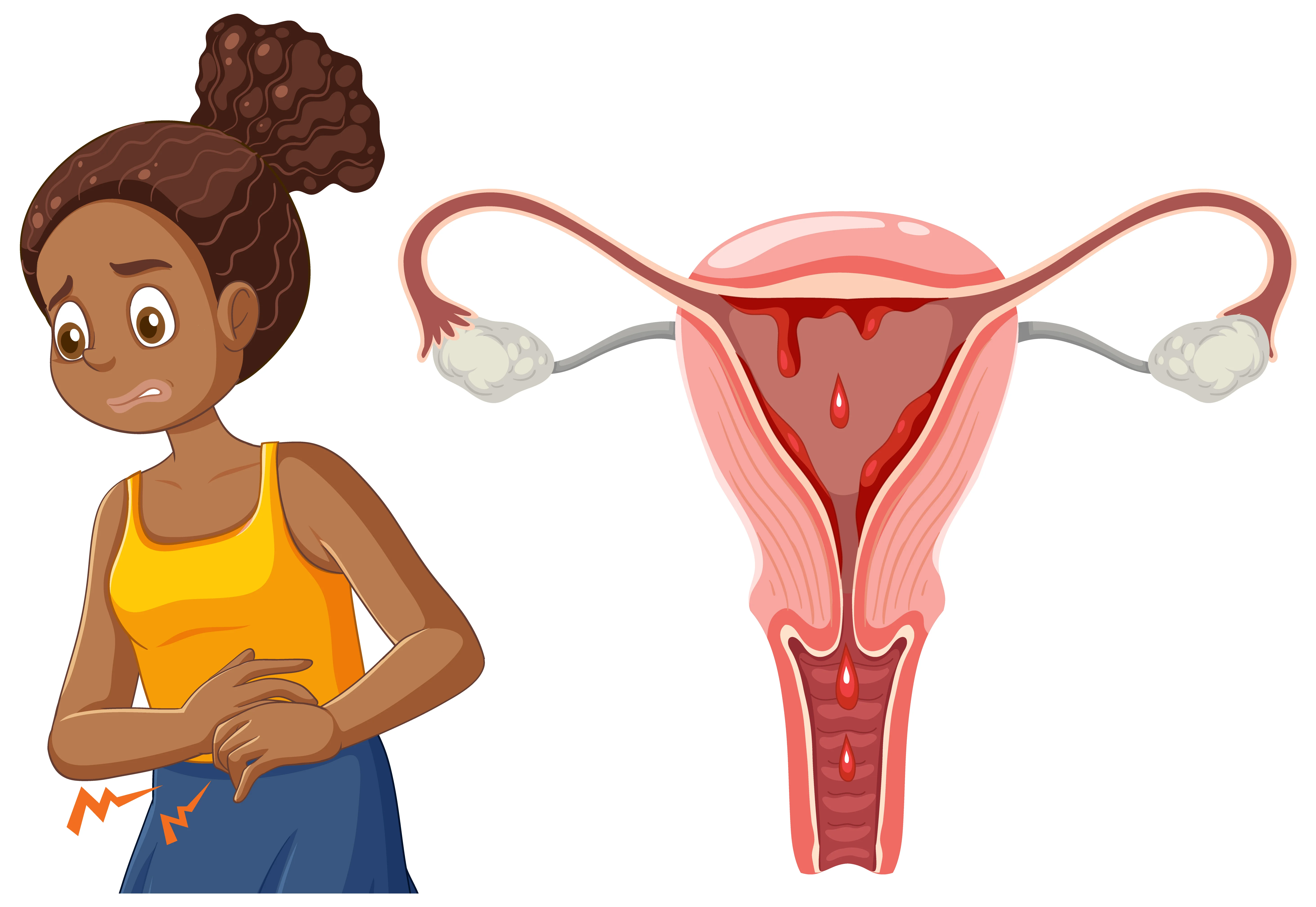 Visual representation of menstrual cycle irregularities and period tracking calendar